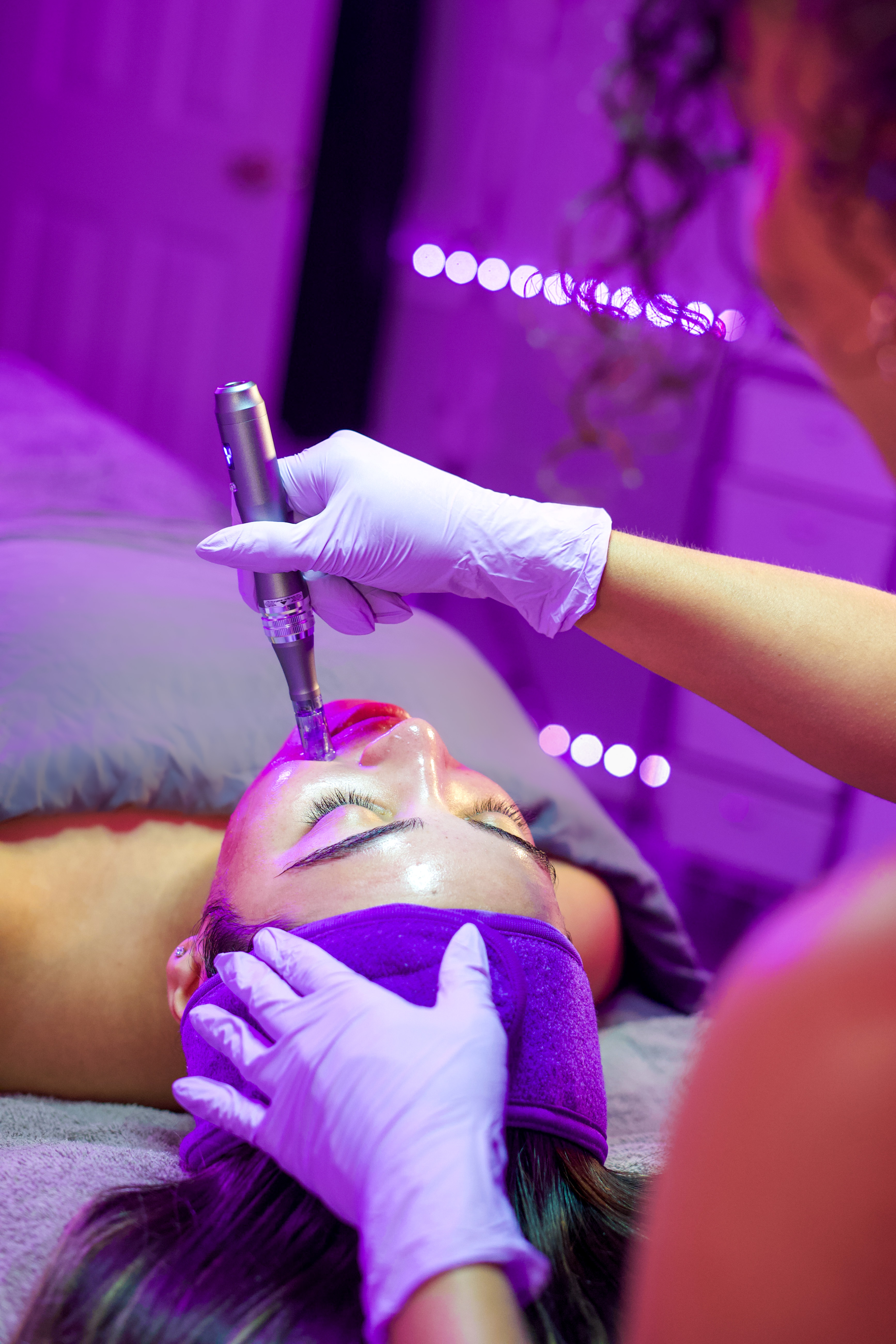Microneedling facial treatment